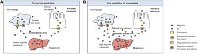 Role of Flavonoids in the Treatment of Iron Overload